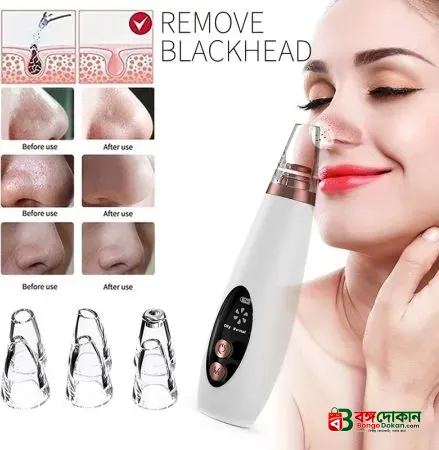 Blackhead Remover Instrument Black Dot Remover Acne Vacuum Suction Face Clean Black Head Pore Cleaning Beauty Skin Care Tool - Black Head Remover - Darma Roller - বাংলাদেশে সেরা দাম ও আকর্ষণীয় কালেকশন - বাংলাদেশে সেরা অফার ও দাম