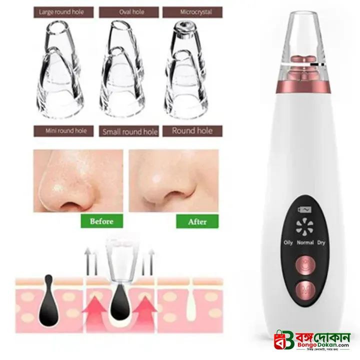 Blackhead Remover Instrument Black Dot Remover Acne Vacuum Suction Face Clean Black Head Pore Cleaning Beauty Skin Care Tool - Black Head Remover - Darma Roller - বাংলাদেশে সেরা দাম ও আকর্ষণীয় কালেকশন - গ্যালারি